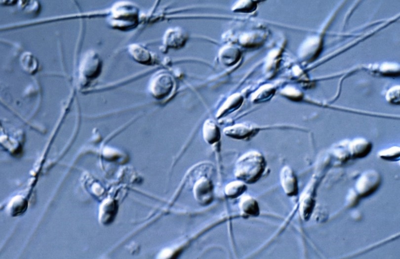 Глава 07: Намален брой на сперматозоидите при мъжа: причини и лечение